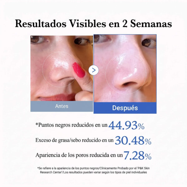 ZERO PORE PAD - Image 3